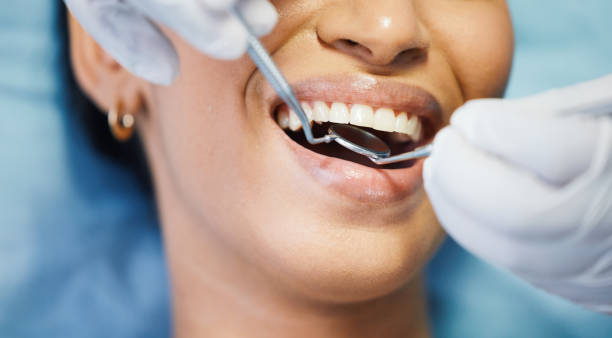 Best Emergency Dental Care for Sports Injuries in Mantua, UT